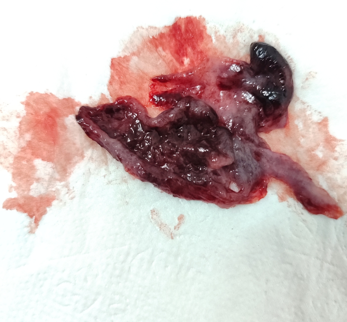 خیلی ببخشید بابت عکس خیلی ببخشید بابت عکس