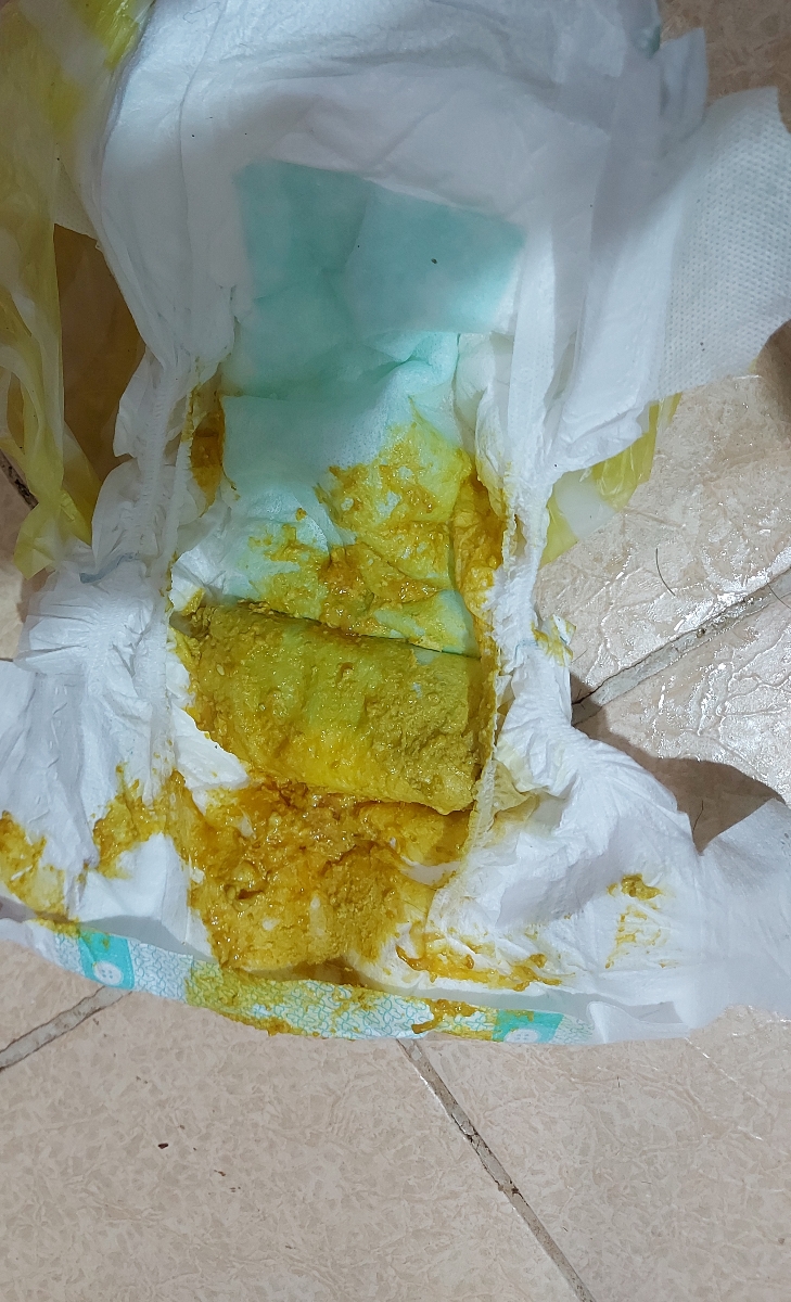 مدفوع نوزاد دوماهه طبیعیه یا خیر