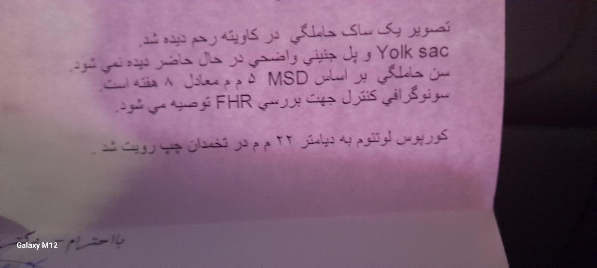 تیر بتا بالا نشونه چیه؟ تیر بتا بالا نشونه چیه؟