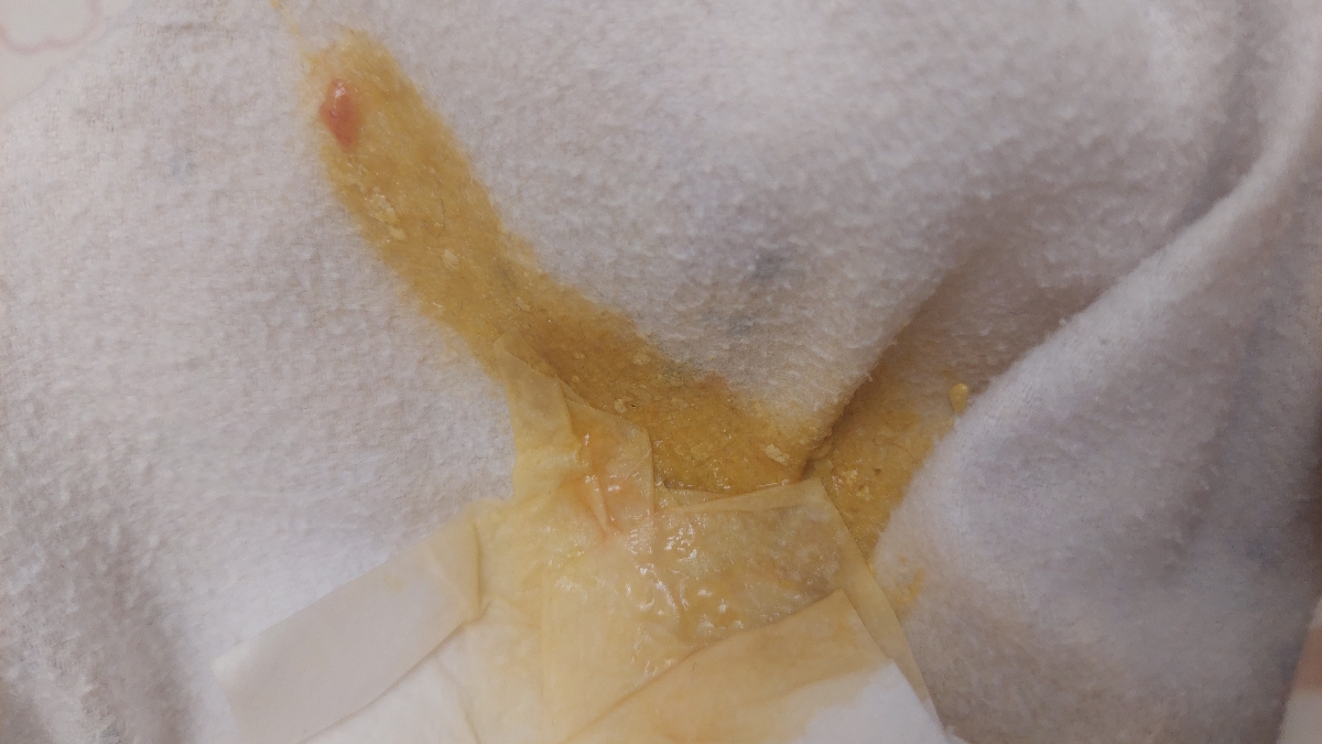 مدفوع نوزاد به همراه عکس