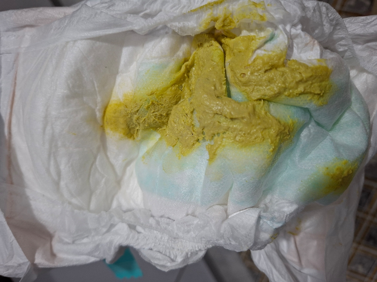 مدفوع چرب نوزاد به همراه عکس