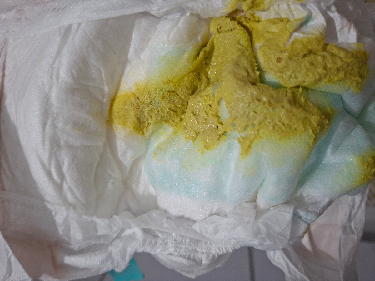 مدفوع چرب نوزاد به همراه عکس