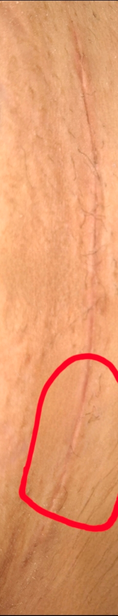 این ناحیه از داخل میسوزه وقتایی که شکم بند میپوشم بیشتر اذیت میشه 