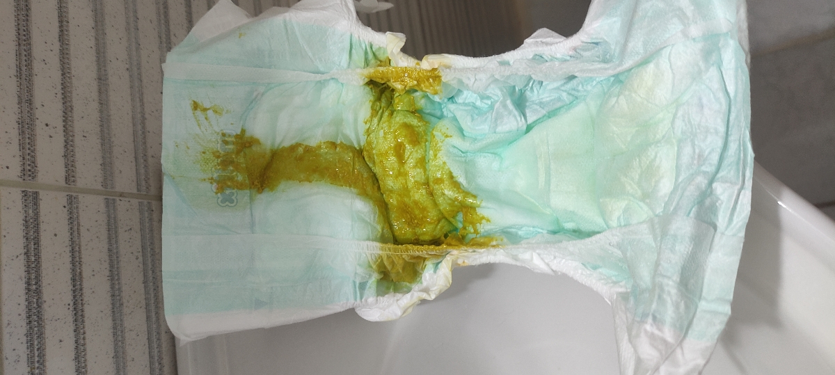 عذرخواهی میکنم بابت عکس.
این دفع همین الان