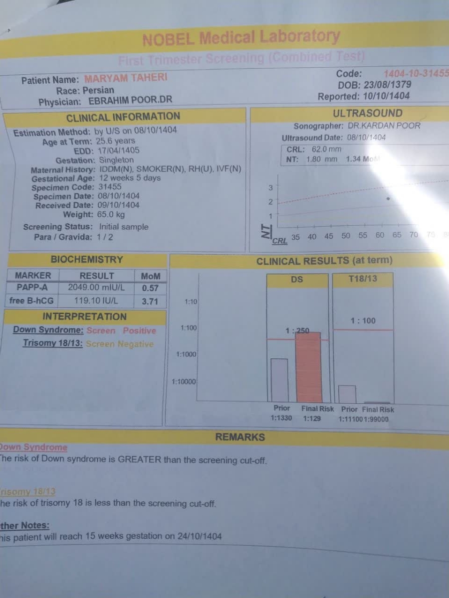 ریسک سندروم داون ازمایش ان تی