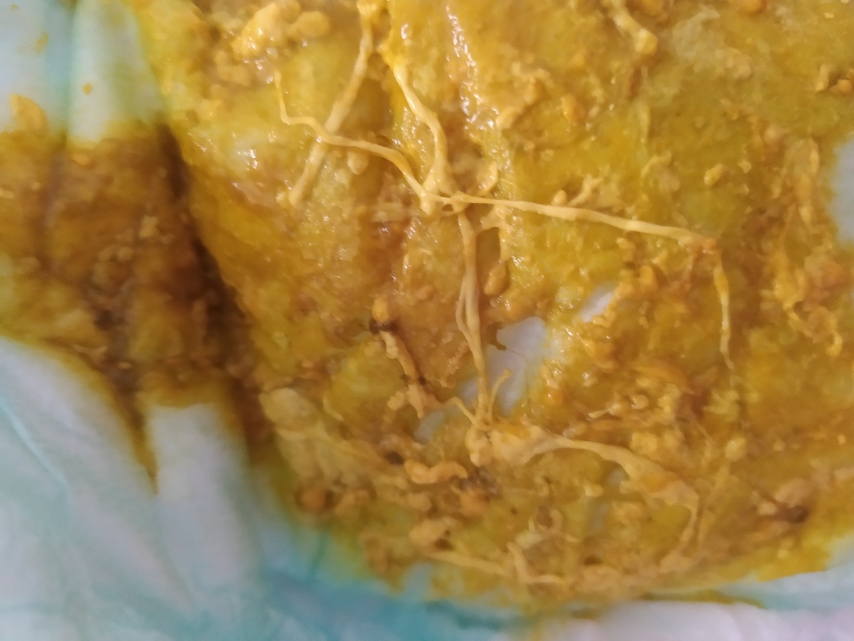 واکنش به شیر خشک آلترا