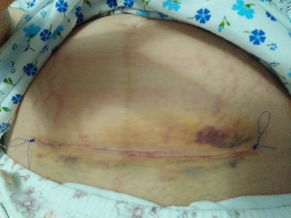 شیردهی شیر مادر و شیر خشک