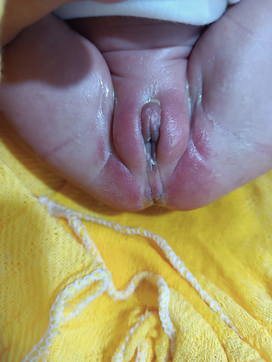 اسهال بودن نوزاد 9 روزه