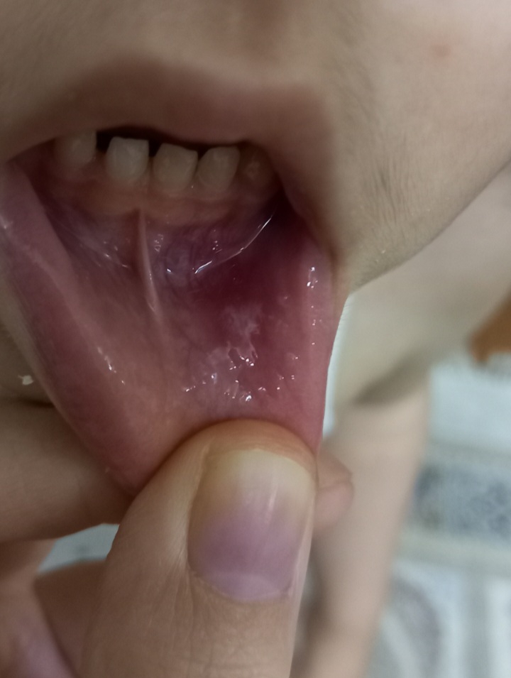 لبش هم اینطوری میشه بیشتر وقتا لبش هم اینطوری میشه بیشتر وقتا