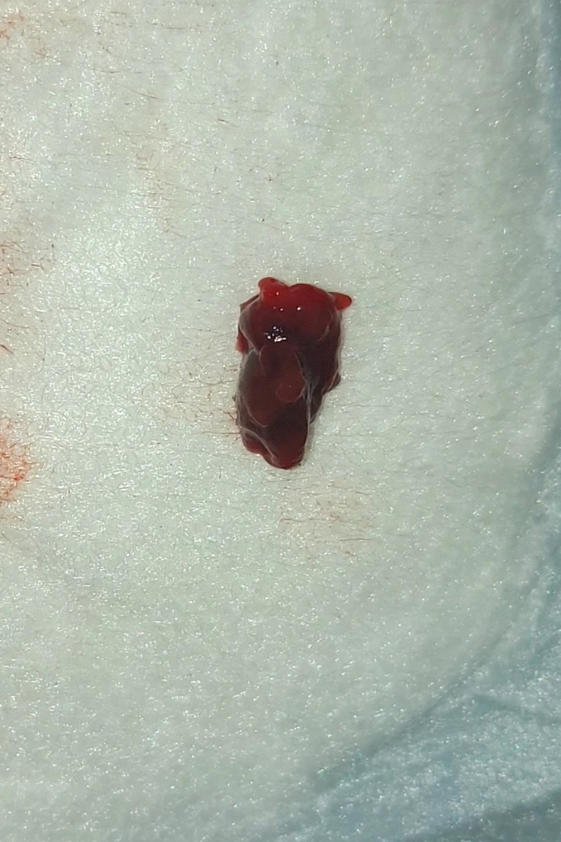 ببخشید بابت عکس ببخشید بابت عکس