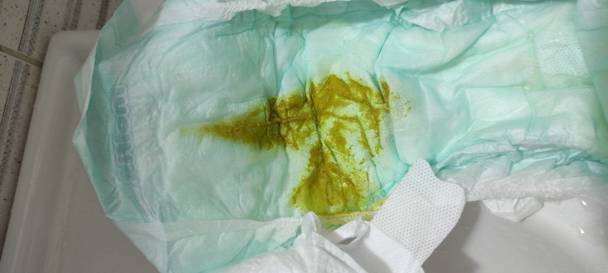 عذرخواهی میکنم دکتر...
این دفع الانه...از صبح سومین مرتبه عذرخواهی میکنم دکتر...
این دفع الانه...از صبح سومین مرتبه