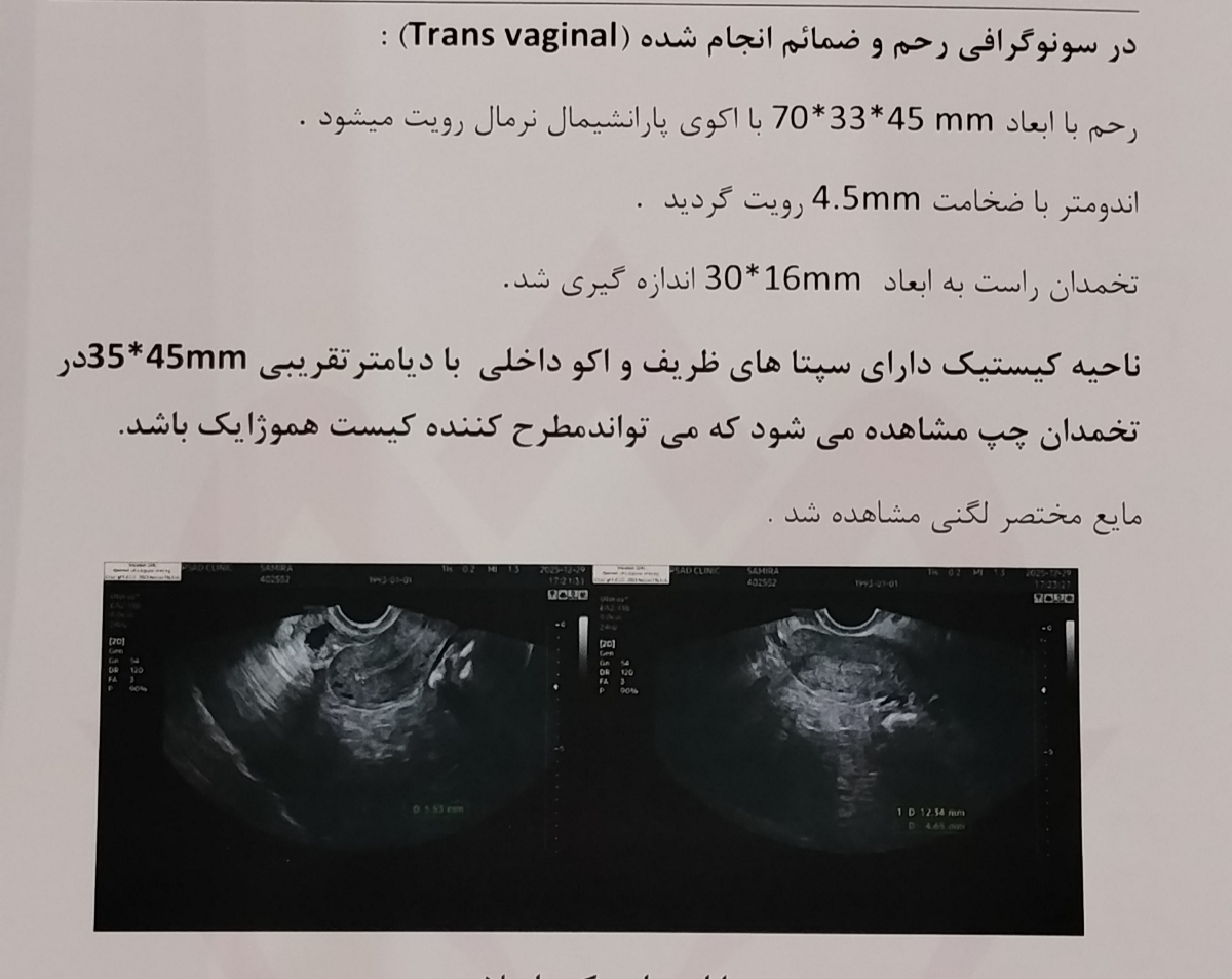 دلیل خونریزی بعد پریودی