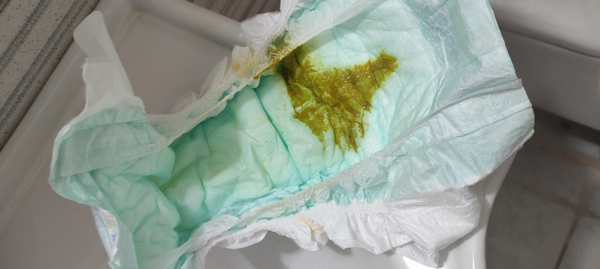 دکتر دفع بعدی... دکتر دفع بعدی...