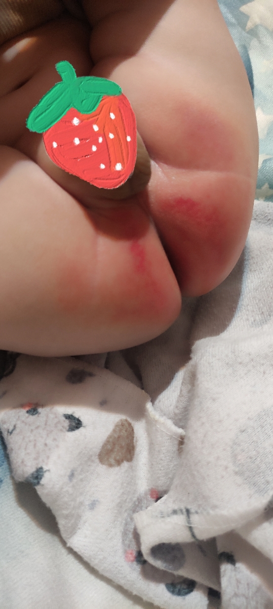 دکتر سوختگی پاهاش در این وضع🥺 دکتر سوختگی پاهاش در این وضع🥺