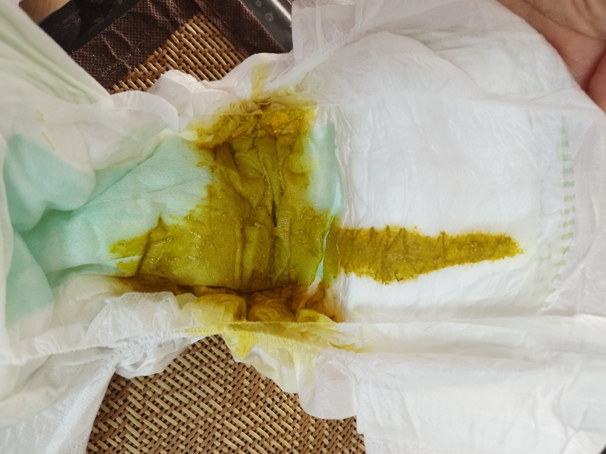 قطره پدی لاکت برای نوزاد