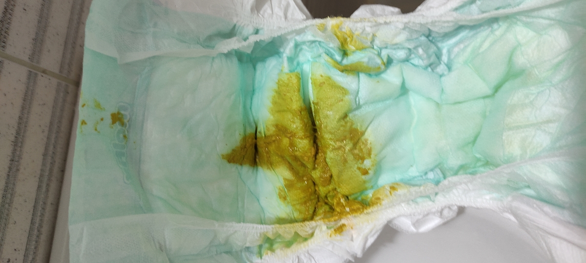 عذرخواهی بابت عکس عذرخواهی بابت عکس