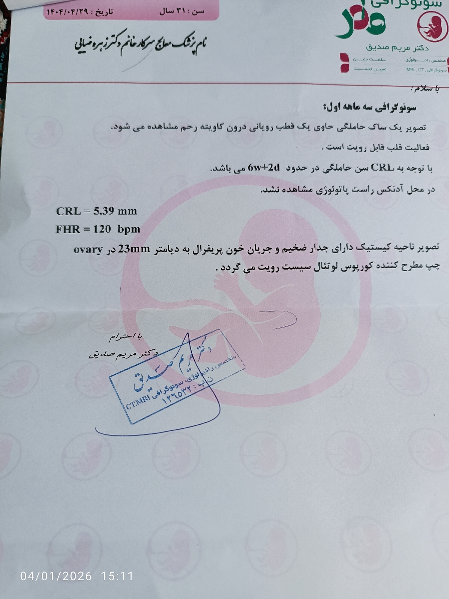 تاریخ مناسب برای سزارین