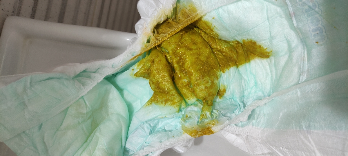 دومین بار دفع دومین بار دفع