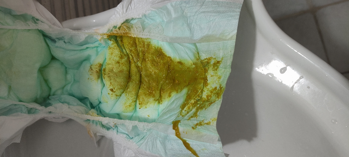 عذر میخوام
دکتر جون بازم توش خلطی هست
چیکار کنم عذر میخوام
دکتر جون بازم توش خلطی هست
چیکار کنم