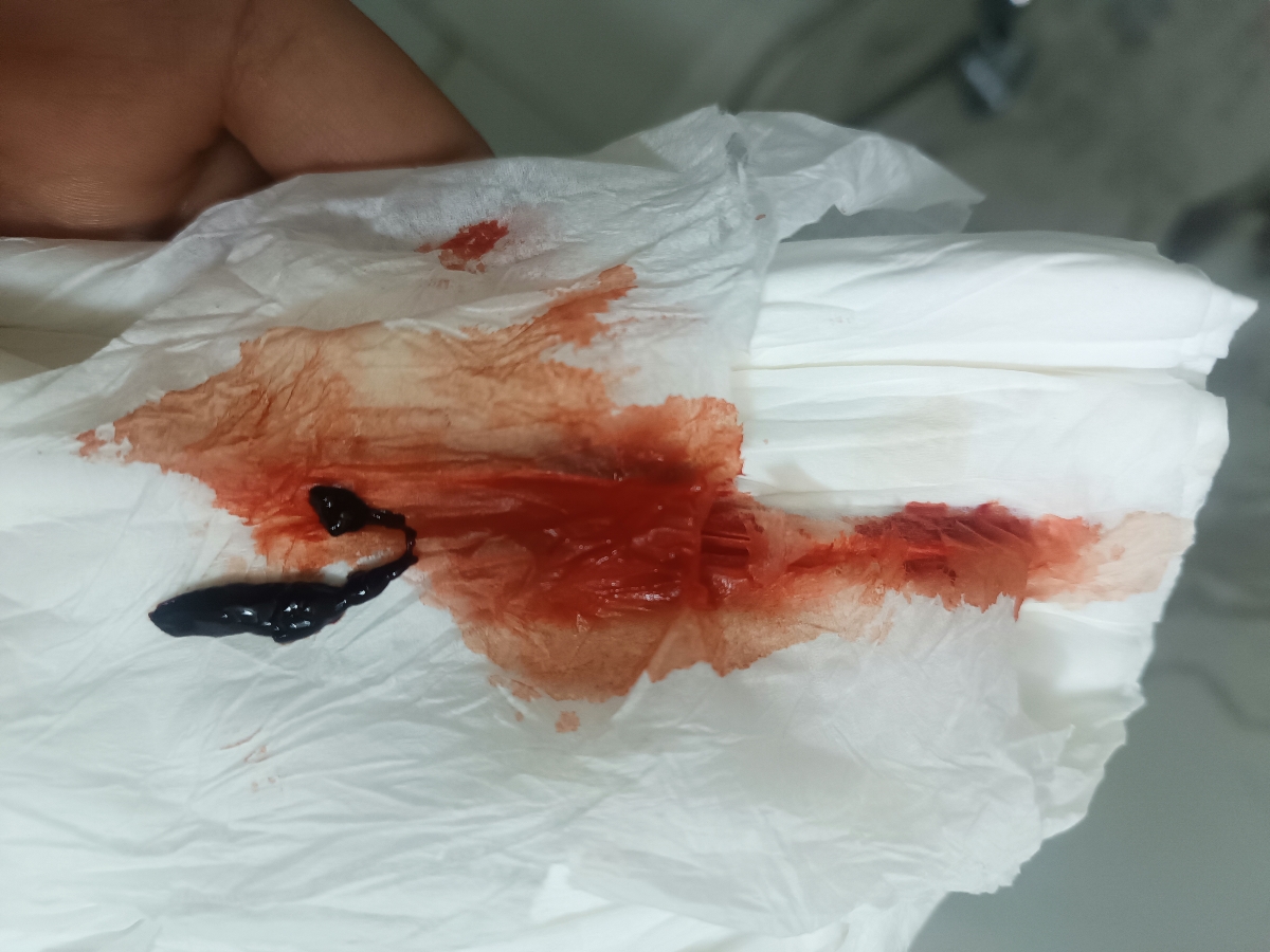 الان اینجوری 