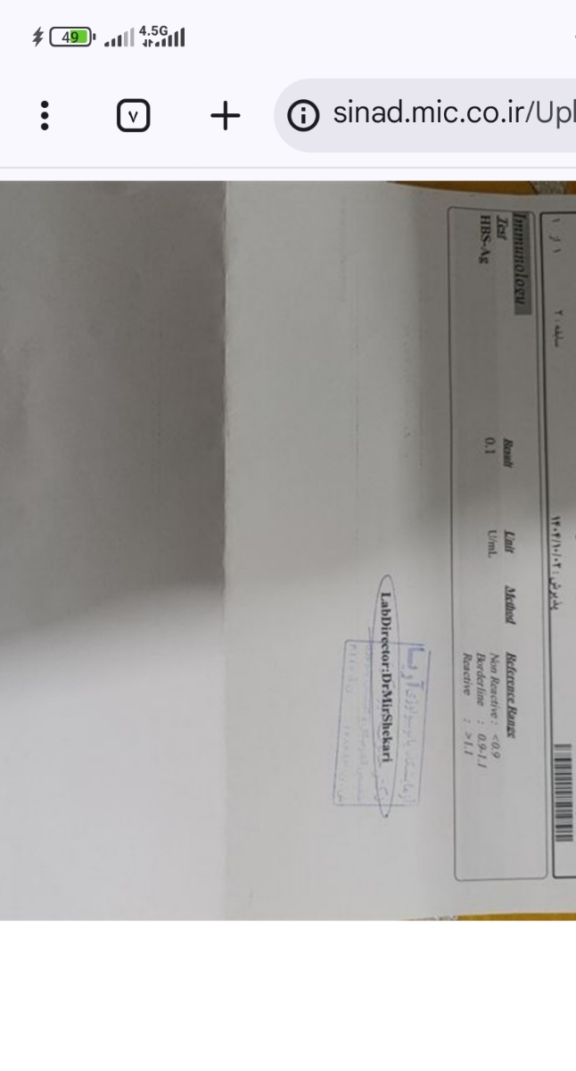 این آزمایش منظورتون هست خانم دکتر 