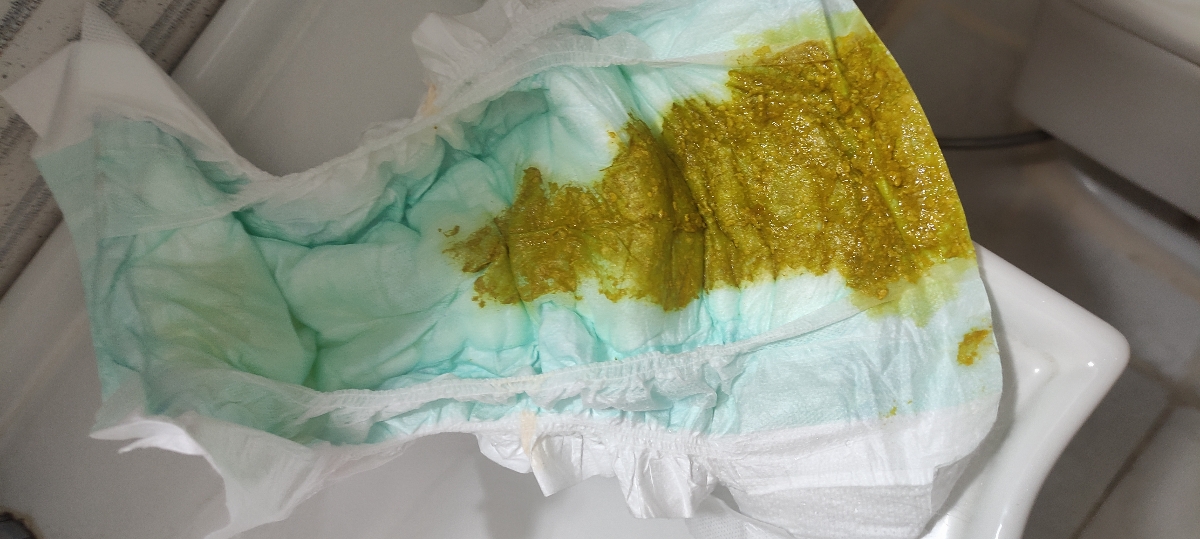 دکتر این دفع امروز صبح
خلطی نیست درسته؟؟ دکتر این دفع امروز صبح
خلطی نیست درسته؟؟