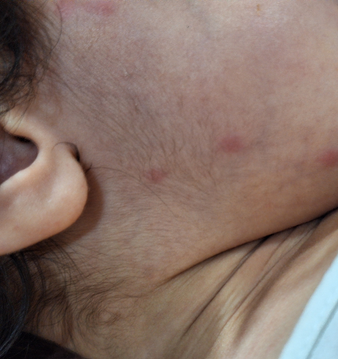 زدن دونه های یهویی