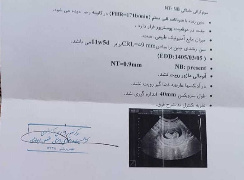 دکتر عزیز غربالگری دومم رو بررسی میکنید لطفا