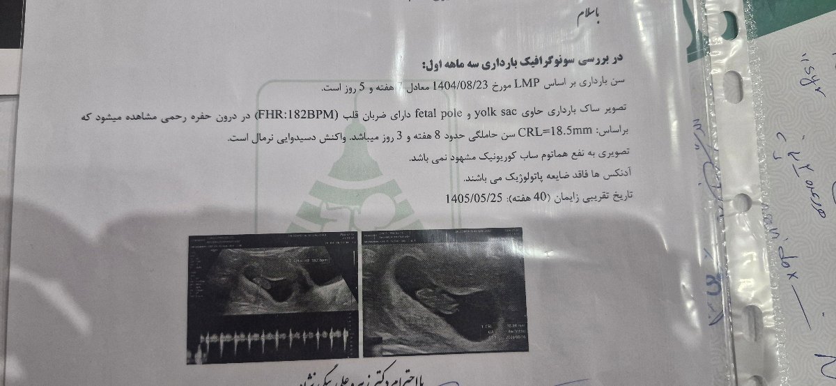 درد شدید بین دوتا کتف
