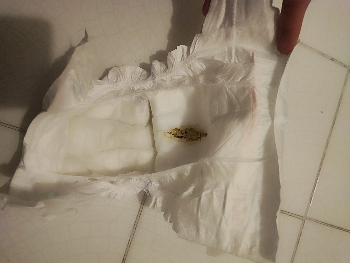 مدفوع سکه ای نوزاد مدفوع سکه ای نوزاد