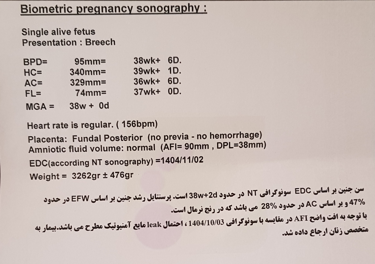 بررسی سونوگرافی آخر بارداری بررسی سونوگرافی آخر بارداری