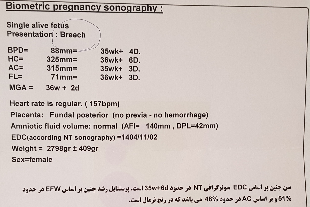 بررسی سونوگرافی آخر بارداری بررسی سونوگرافی آخر بارداری