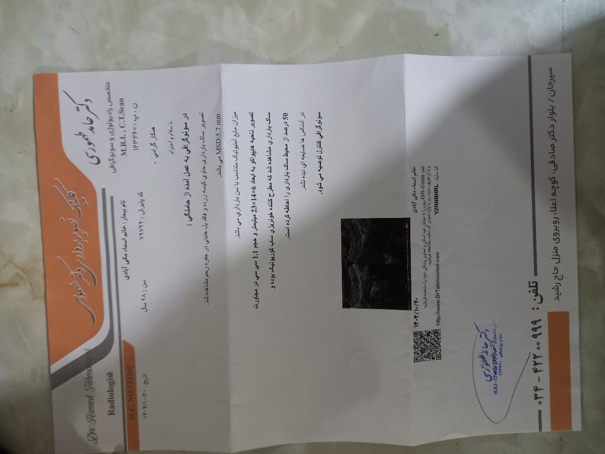 این سونوی من و اخرین پریودیم در 18آذر بوده