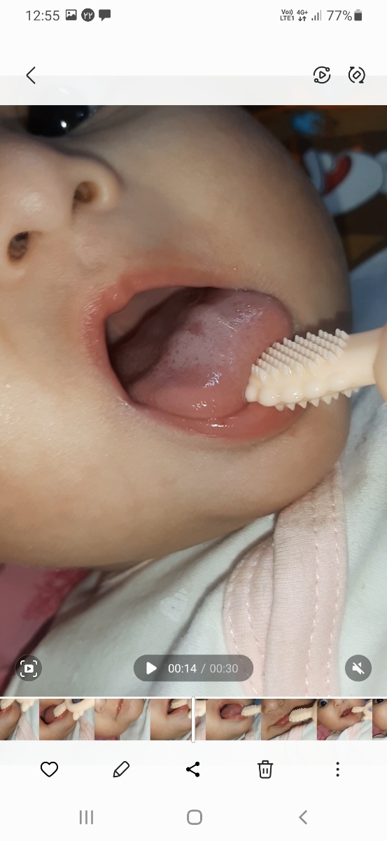 خانم دکتر میشه زبون دخترمو ببینین