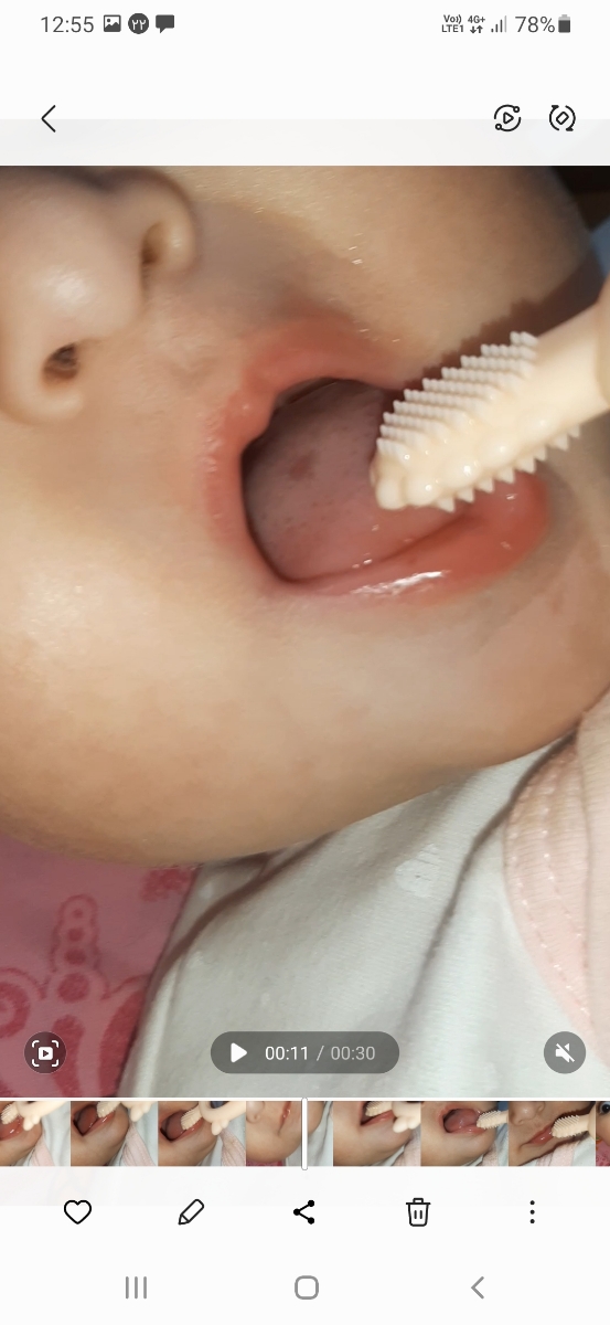 خانم دکتر میشه زبون دخترمو ببینین