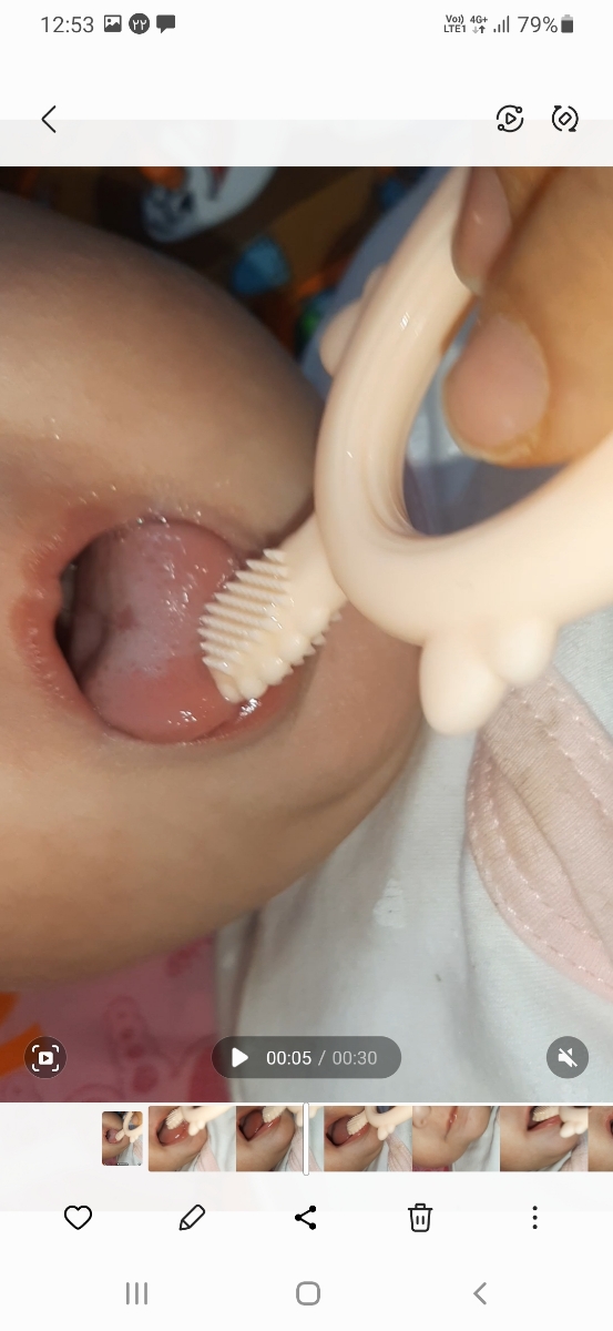 خانم دکتر میشه زبون دخترمو ببینین