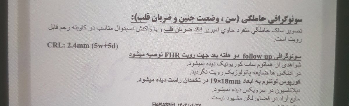 قلب جنین ۸ هفته
