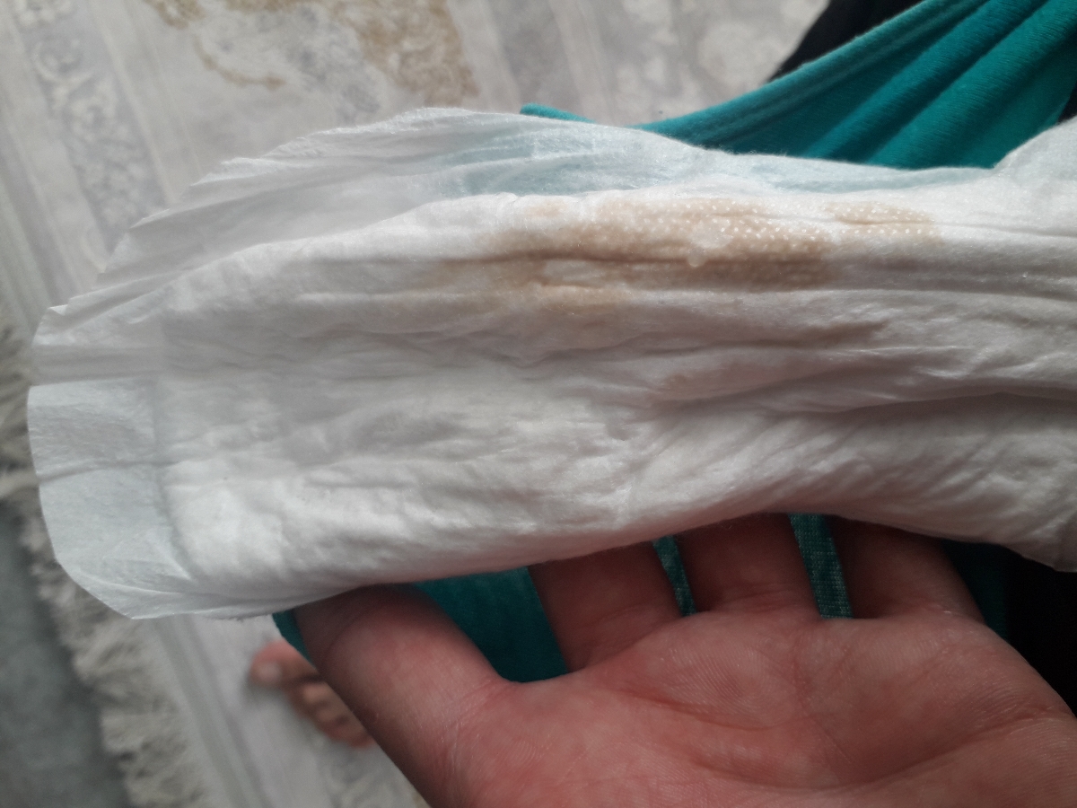 عفونت و ترشح بعد از سزارین عفونت و ترشح بعد از سزارین