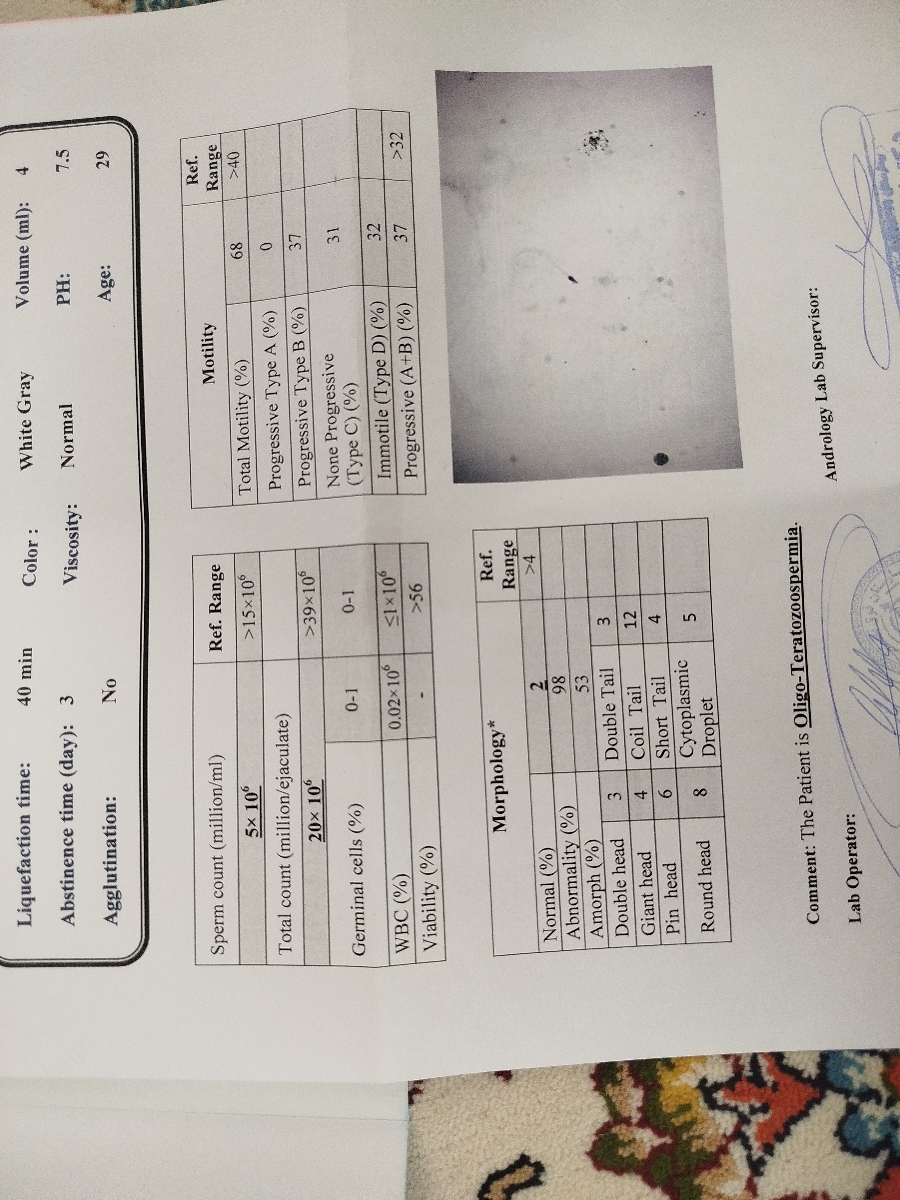 آزمایش اسپرم و آی وی اف