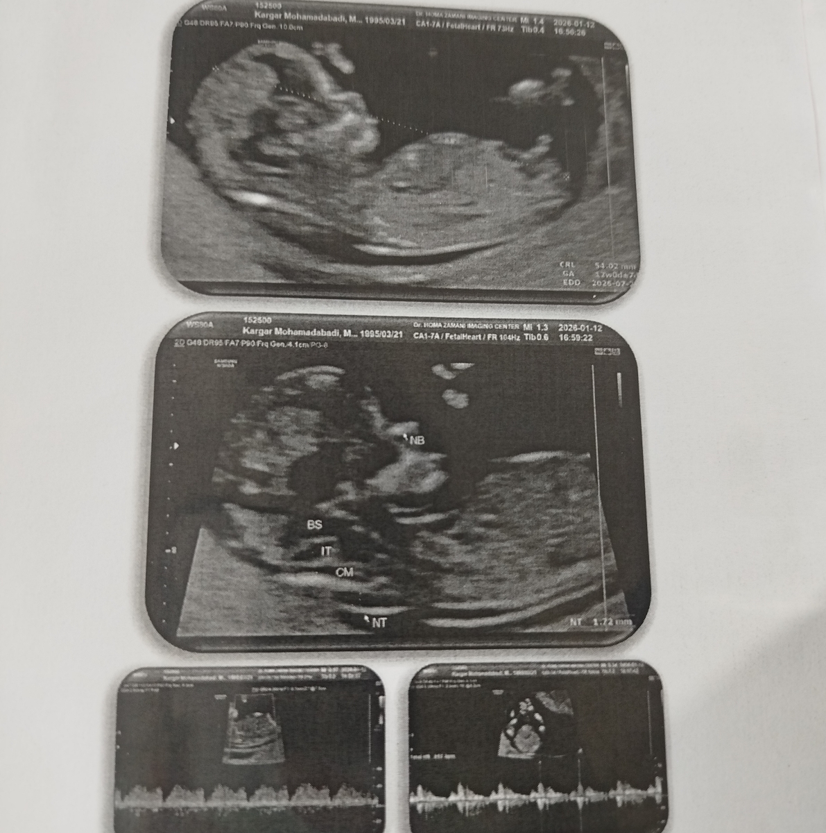 متخصصین جنسیت یه لحظه میایین