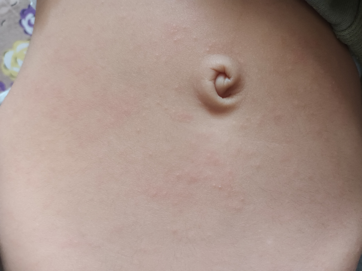 این رزوئولاس برا بچه من.این مدلی بود