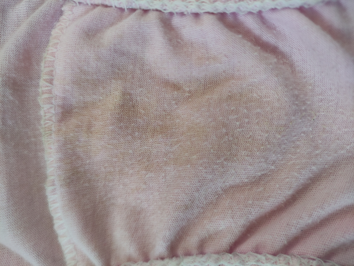 ترشح زردکم رنگ درابتدای بارداری