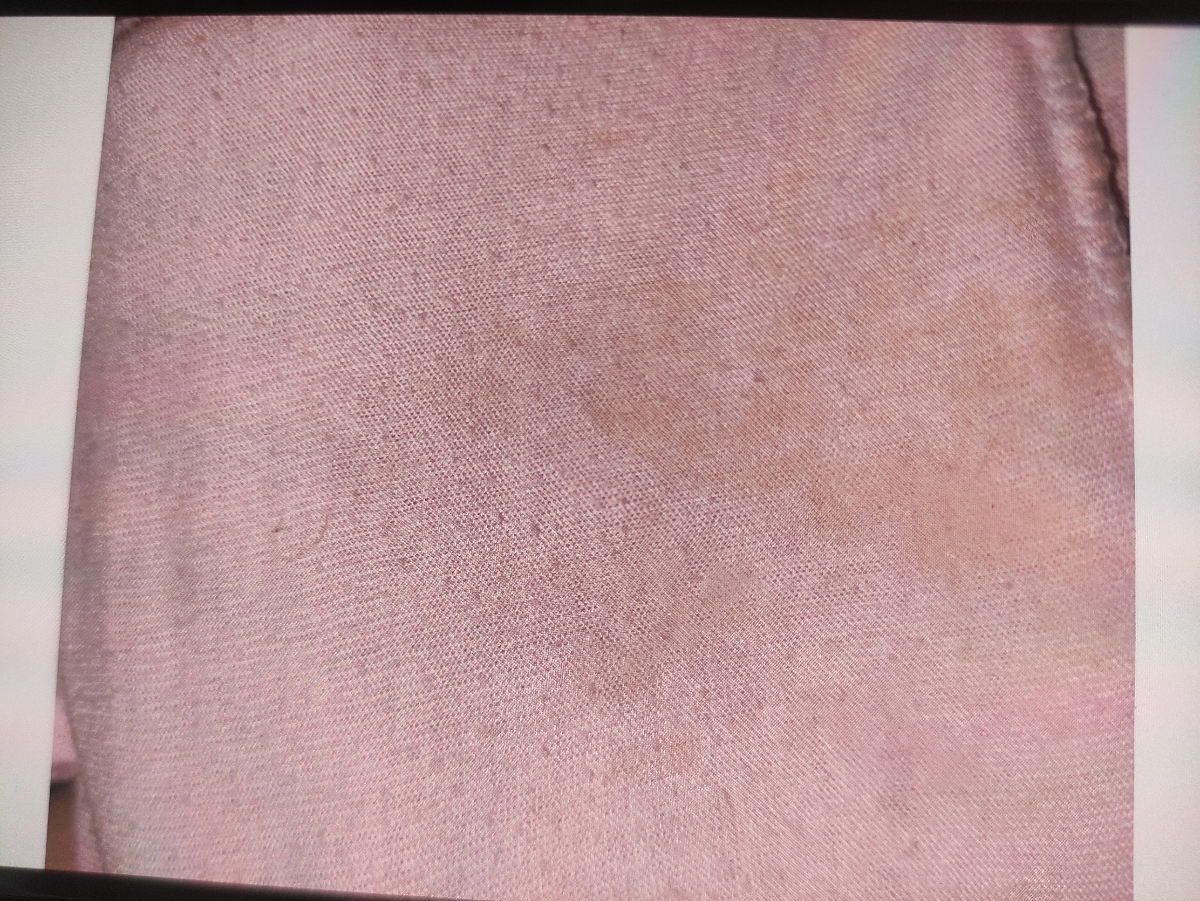 ترشح زردکم رنگ درابتدای بارداری