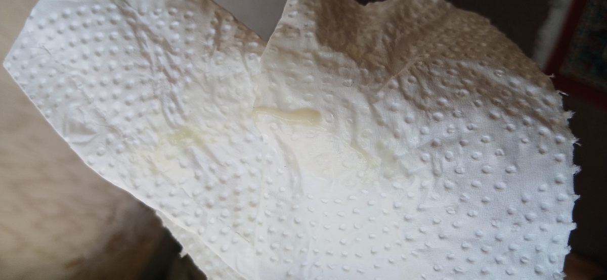 ترشح در بارداری طبیعی هست یا ن