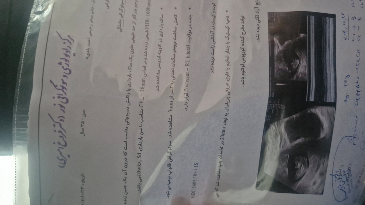 بررسی سونو و نگرانی بایت کاهش ضخامت