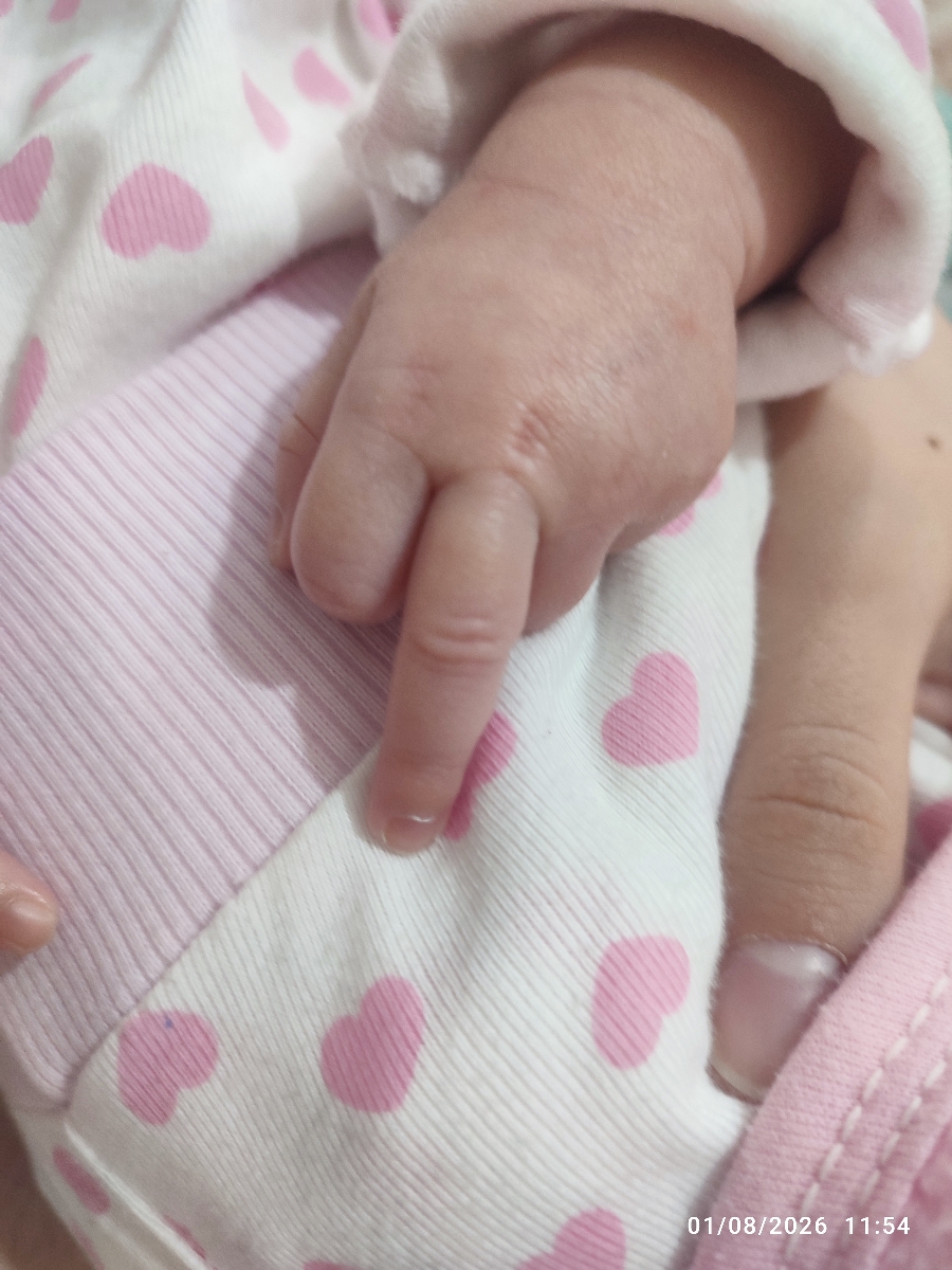 جواب سونوگرافی طول سرویکس جواب سونوگرافی طول سرویکس