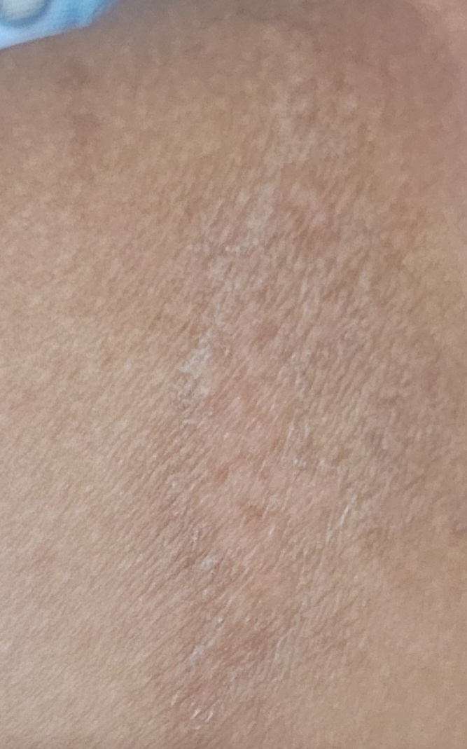 دون دون شدن و قرمزی پا و خوب نشدن بعد ۱۰ روز حاوی عکس