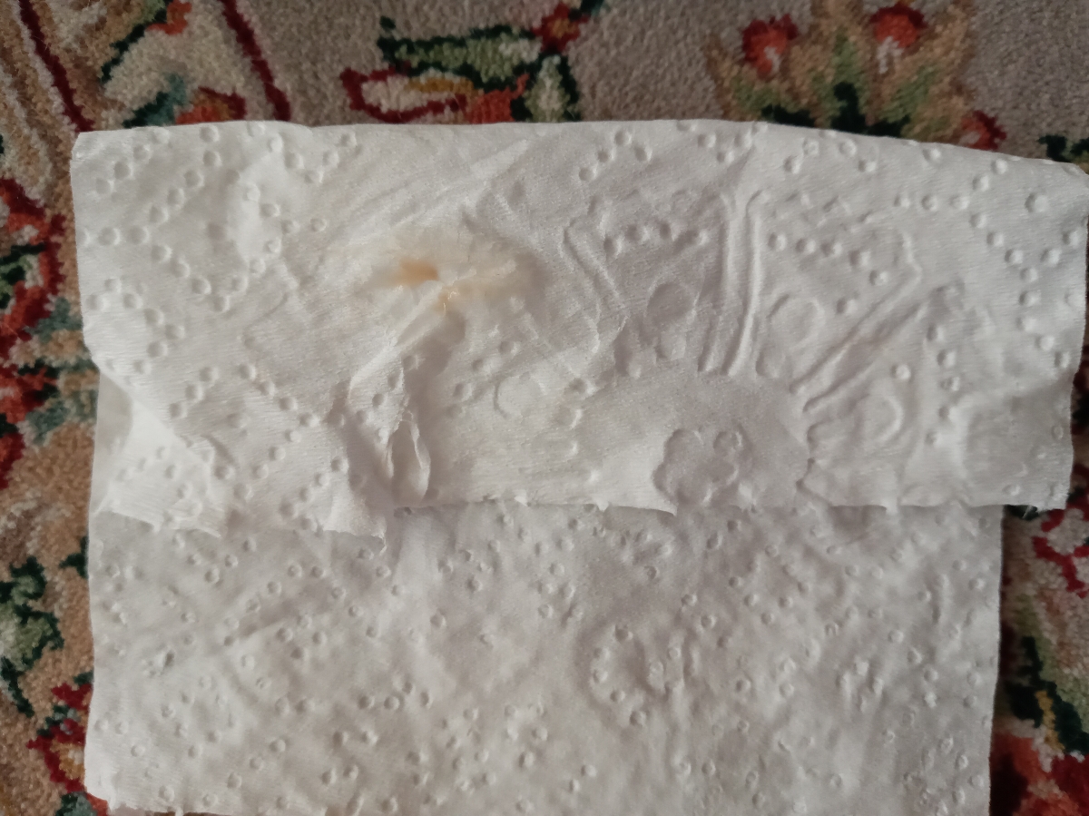 ترشح سبز رنگ در بارداری