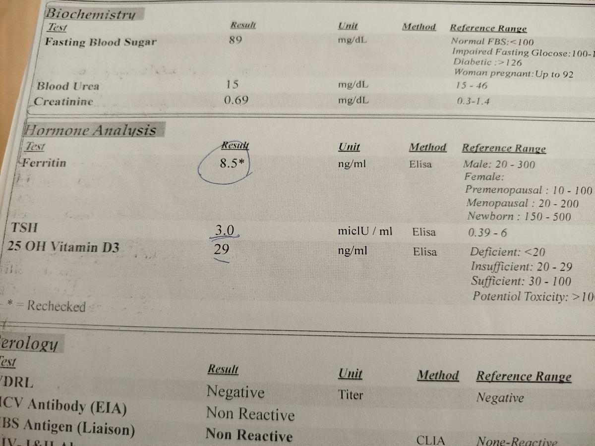 آزمایش فعلی آزمایش فعلی