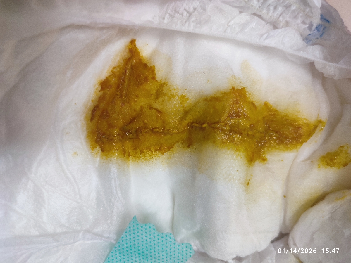 جواب آزمایش تیروئید نوزاد جواب آزمایش تیروئید نوزاد